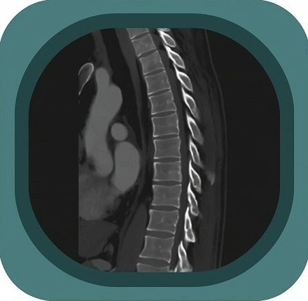CT T spine anatomy icon